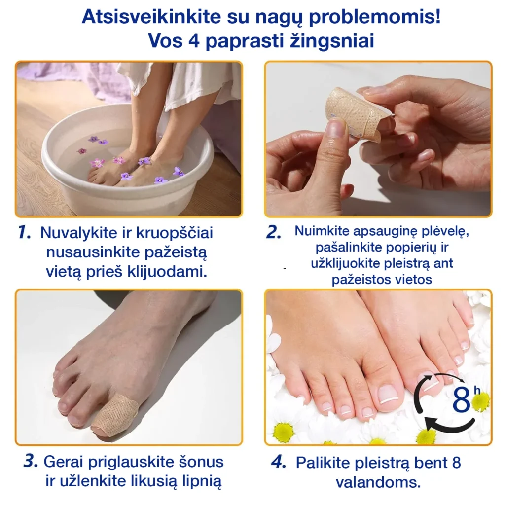 nagu grybelio gydymas